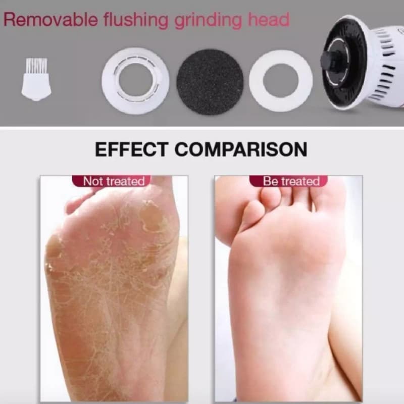 Callus Remover