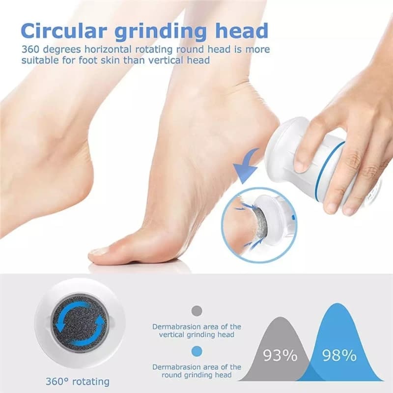 Callus Remover